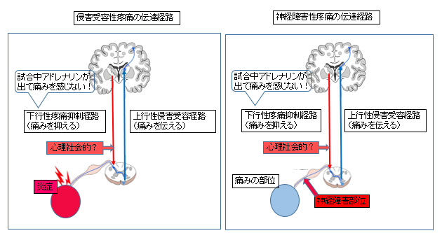 �N�Q��e���u�ɂ̓`�B�o�H�E�_�o��Q���u�ɂ̓`�B�o�H