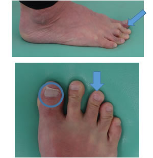 �n�ʂ����ނP