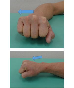 ��̈�����Q