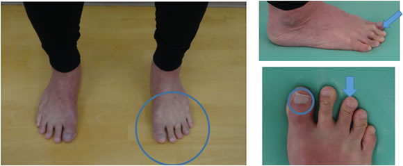 ���́h�n�ʂ����ށh�悤�ɑ���؂ɗ͂����āA�����Ƃ��グ�Ȃ��ōs���܂��B